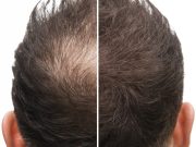Poudre pour Cheveux Homme : Astuces et Conseils pour une Coiffure Impressionnante Poudre pour Cheveux Homme