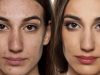 Hydrafacial: Les Avis Négatifs Révélés – Lisez Avant d’Essayer! Hydrafacial avis