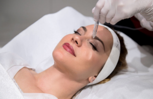 Jet Peel durée de vie : combien de temps durent les résultats ? Effets du Jet Peel