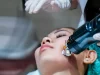 Microneedling : Quand verrez-vous les résultats ? Microneedling