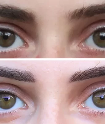 Quelle Crème Utiliser Après une Séance de Microblading : Guide Complet Crème Après une Séance de Microblading