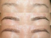 Détatouage Sourcil : Techniques, Coûts et Témoignages Détatouage Sourcil