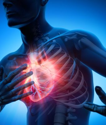 Le syndrome du cœur brisé : comment le stress peut affecter votre cœu Le syndrome du cœur brisé