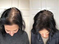 J’ai essayé les remèdes naturels pour épaissir mes cheveux : bilan après 90 jours Cheveux fins - comment les épaissir rapidement