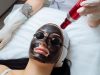 Carbon Peel : tout savoir sur ce traitement pour une peau éclatante Carbon Peel