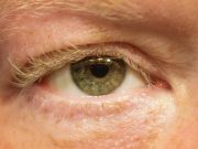 Est-ce que les cils repoussent ? Tout ce qu’il faut savoir Est-ce que les cils repoussent