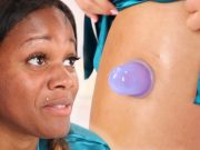Ventouse cellulite : les meilleurs conseils pour un massage efficace Ventouse cellulite