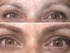 Résultat tatouage sourcils : photos avant/après