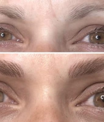 Résultat tatouage sourcils : photos avant/après