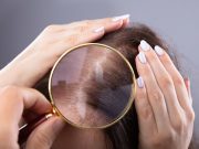 Pourquoi la greffe capillaire séduit de plus en plus d’hommes… et de femmes Pourquoi-la-greffe-capillaire-seduit-de-plus-en-plus-dhommes