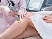 Épilation lumière pulsée : délai idéal entre les séances delai-entre-2-seances-epilation-lumiere-pulsee