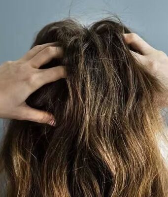 Démangeaison cuir chevelu : causes cachées et solutions rapides demangeaison-cuir-chevelu