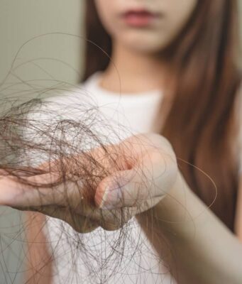 Effluvium cheveux : avis de dermatologues et solutions effluvium-cheveux-avis