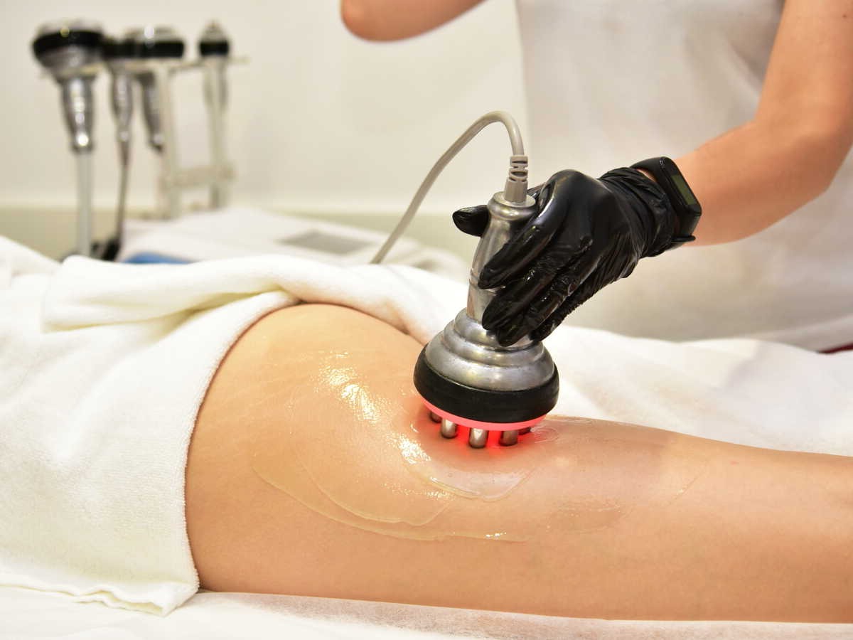 lipo cavitation machine