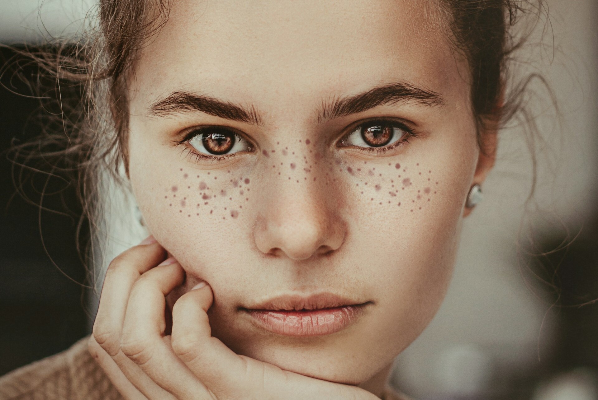 tatouage tache de rousseur avant apres