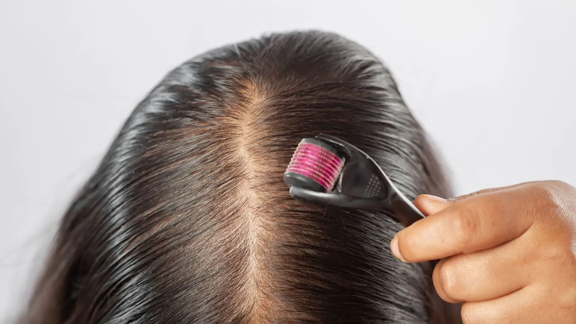 dermaroller cheveux