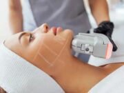 HIFU : avis négatifs, risques et limites du lifting sans chirurgie hifu-avis-negatif