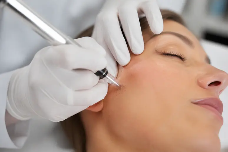Précision du geste lors de la réalisation d'un tatouage de taches de rousseur sur le visage